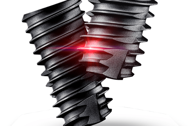 インプラントの構造と素材