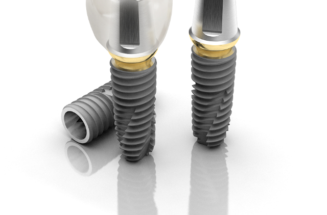 インプラントの種類